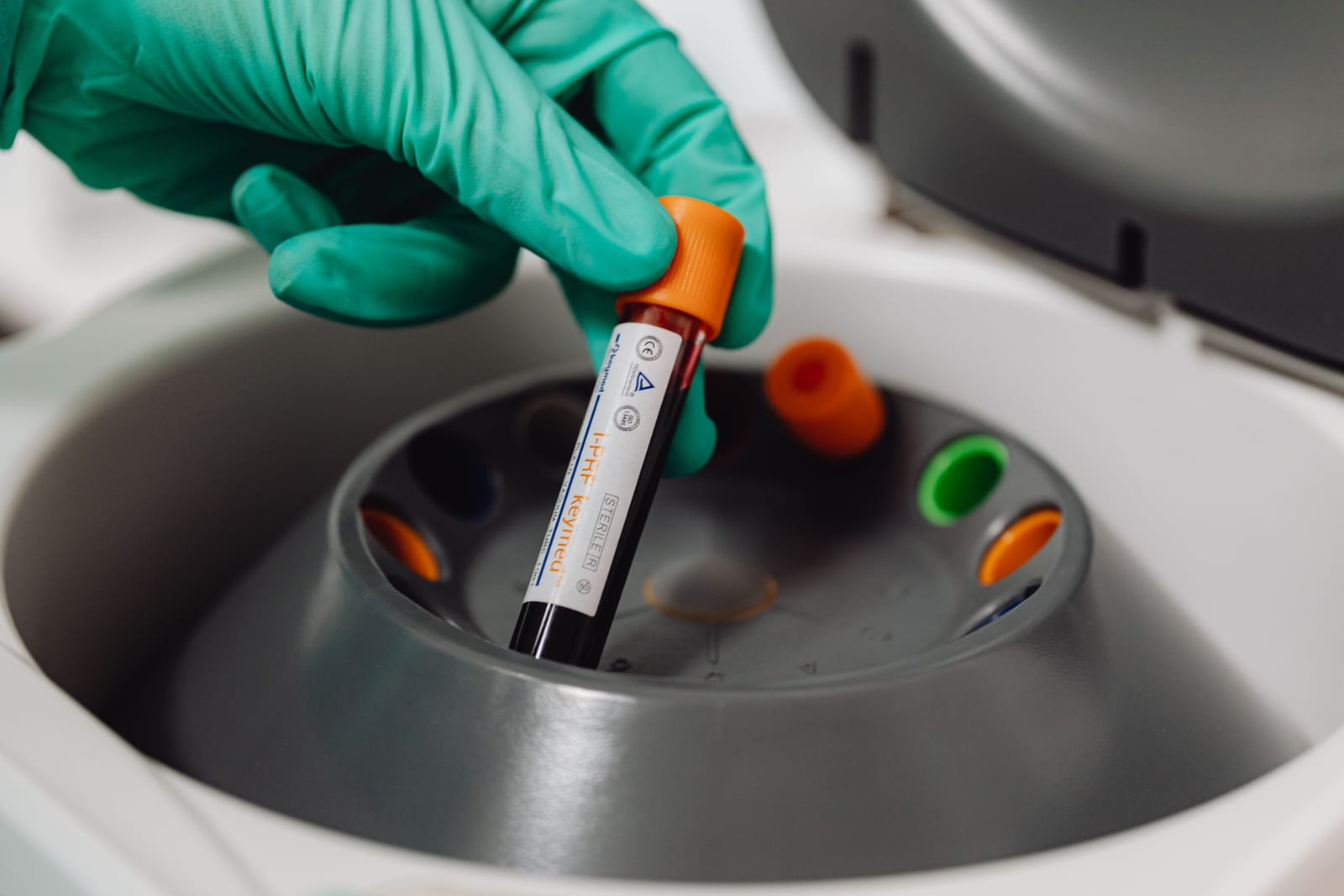 A gloved hand holding a blood sample vial ready for centrifuge processing