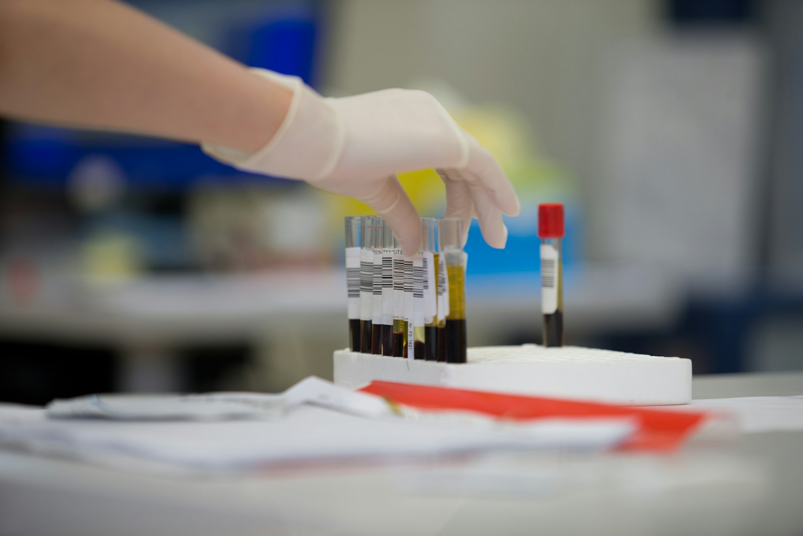 A gloved hand holding a test tube filled with blood in a clinical lab setting